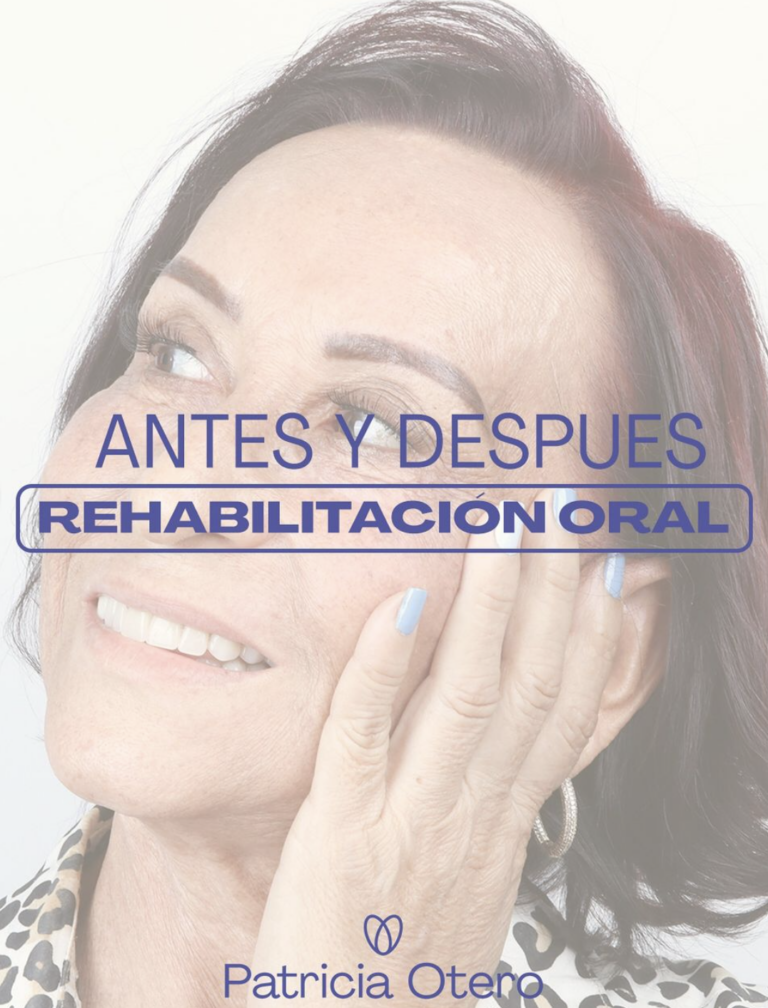 rehabilitación oral Dra Patricia Otero