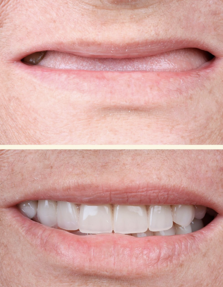 rehabilitación oral Dra Patricia Otero