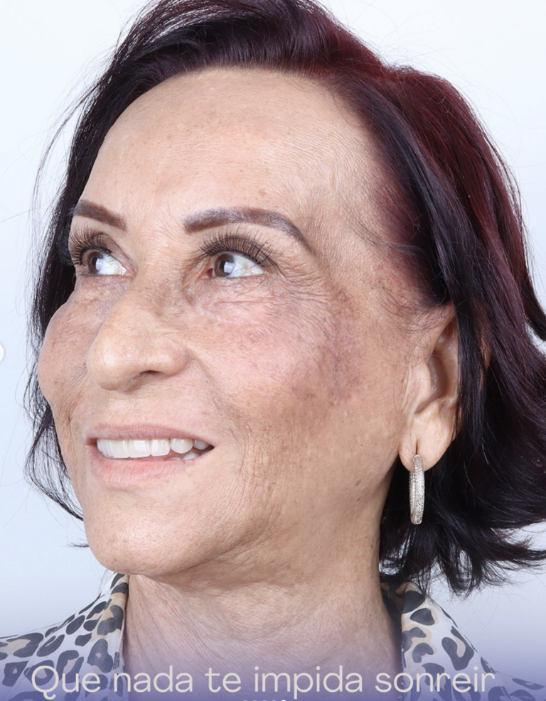 rehabilitación oral Dra Patricia Otero