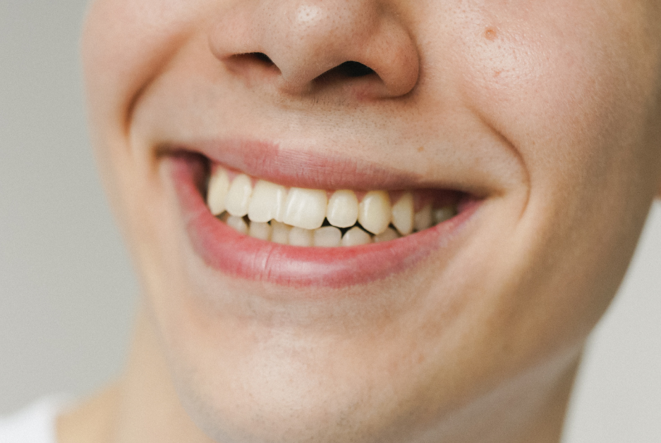 Dientes blancos