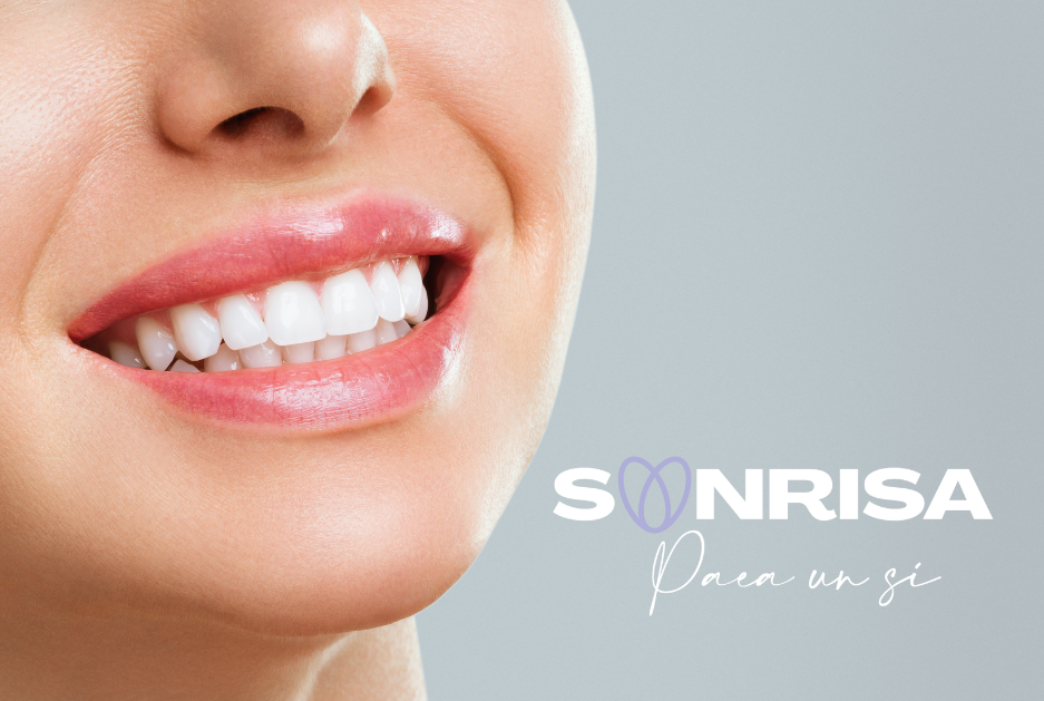 tratamientos dentales para novios