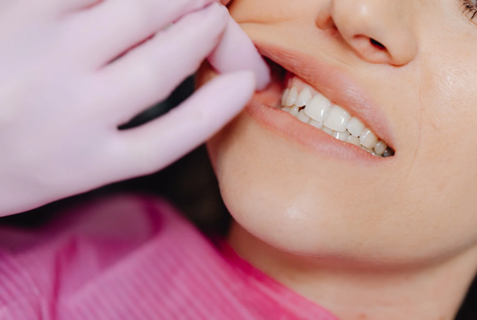 Sonrisa dientes